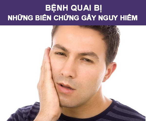 Bệnh quai bị và những biến chứng nguy hiểm