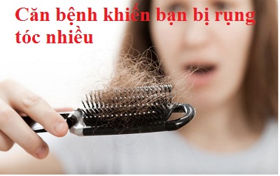 Các căn bệnh khiến bạn bị rụng tóc nhiều