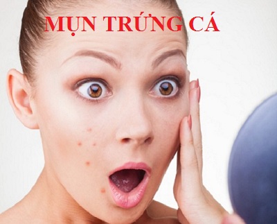 Mụn trứng cá
