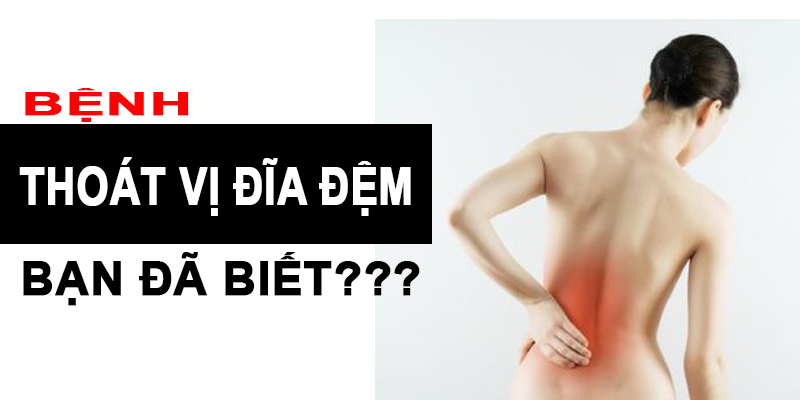 Bệnh thoát vị đĩa đệm